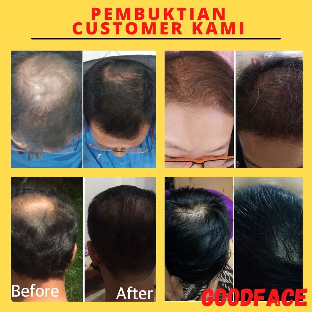 PENUMBUH RAMBUT KEBOTAKAN - PELEBAT RAMBUT - BIO HERBAL GINSENG SHAMPO HAIR TONIC MINYAK KEMIRI