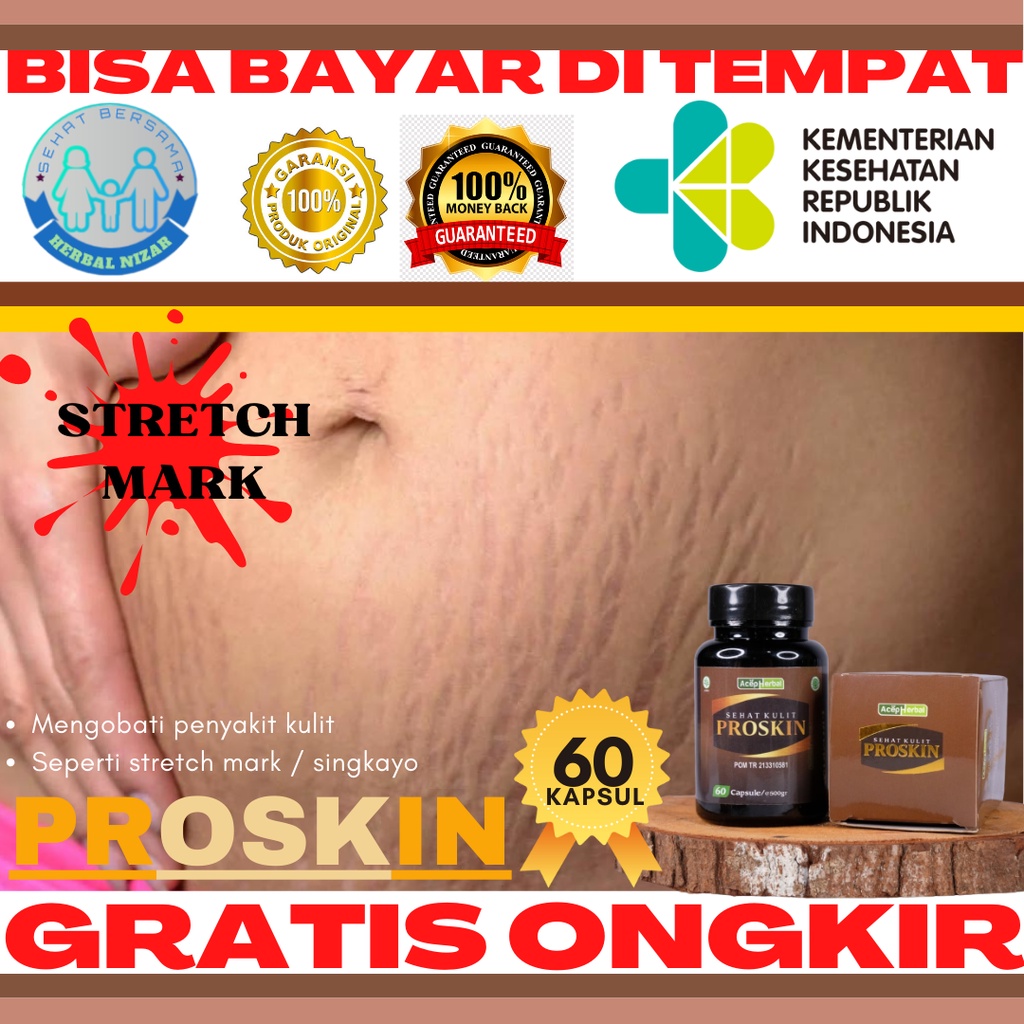 Obat Singkayo, Obat strecmark, Obat Stretch Mark, Obat Penghilang Bekas Hamil di Perut, Obat kapsul 