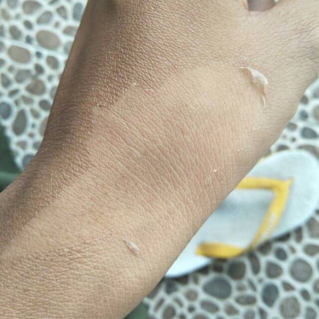 BODY PEELING