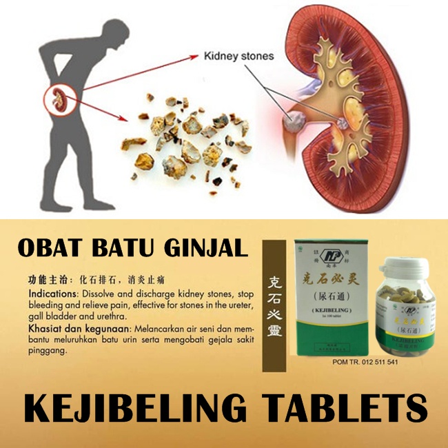 

Kejibeling Tablets Obat ginjal untuk sakit pinggang urin berbusa penghancur batu ginjal herbal BPOM