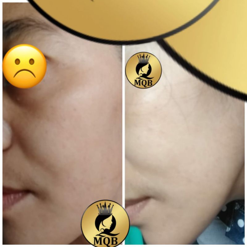 PAKET MQBeauty Brightening Series [free red jelly + cream jerawat] Skincare BPOM - MQ Beauty Krim Perawatan Wajah [Bayar Ditempat] [Asli] [Original] [Cod]-8