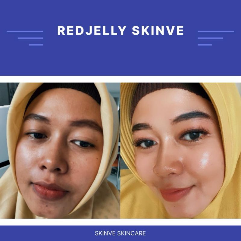 Serum SKIN VE Red Jelly Whitening Glow