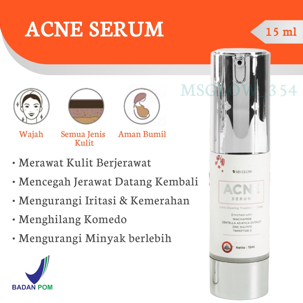 MS Glow Original Whitening Acne Luminous Ultimate Series - Paket MS Glow Whitening Acne Luminous Ultimate Original - Skincare MS Glow Paket Whitening Acne Luminous Ultimate Ori Original - MS Glow Beauty Official Store Resmi Cikarang Bekasi Bandung Jakarta-Acne Serum