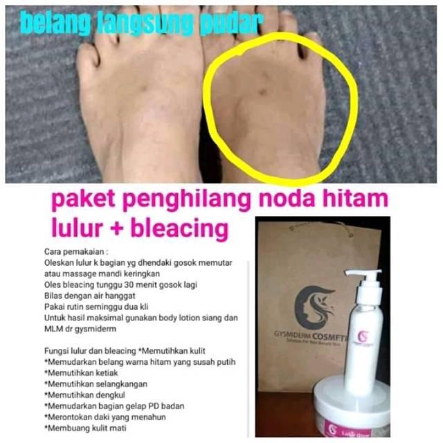 Lulur + bleaching Gysmiderm