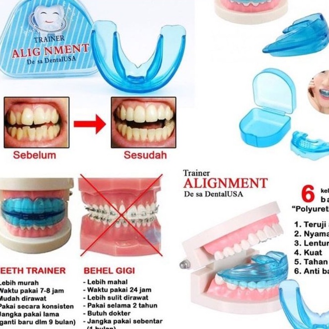 Made In USA Alat Perapi Gigi Original - Behel Gigi Lepas Pasang  -Teeth