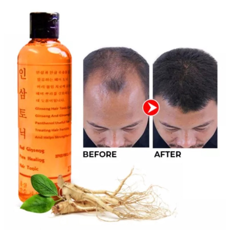 Red Ginseng Hair Tonic Original - Penumbuh dan Melebatkan Rambut &amp; Mencegah Rontok