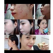 sabun kedas beauty, Pemutih Wajah, Badan ,Flek ,Ketiak ,Pria, Original-7