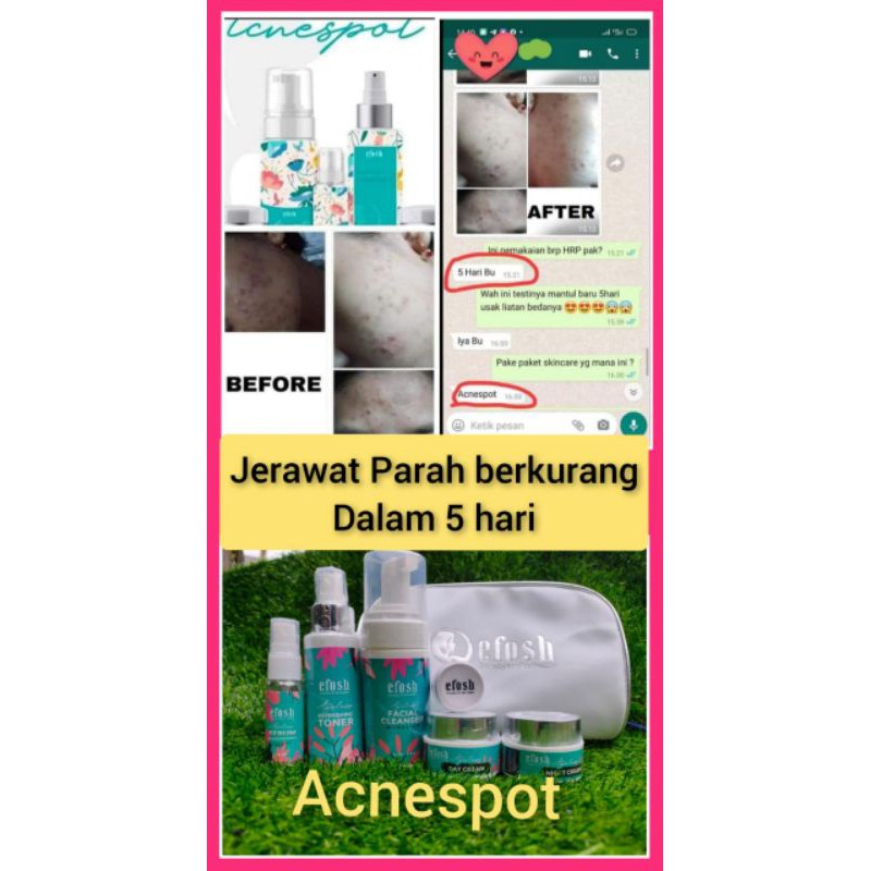 Efosh Skincare Bpom Original Viral