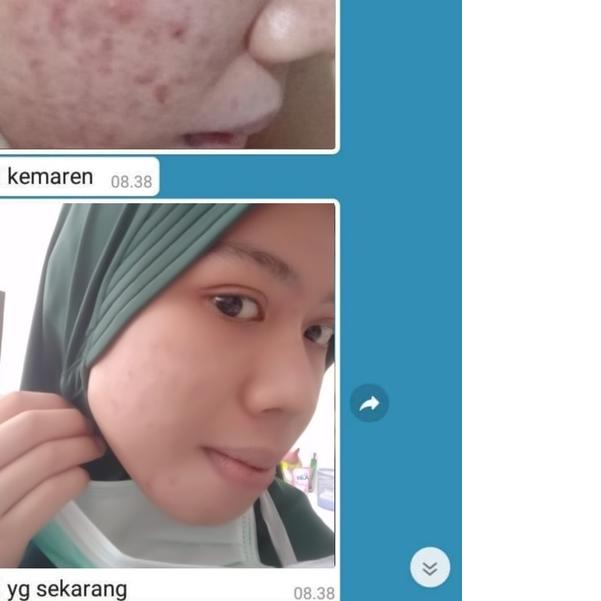 ← ADERA FACE SERUM ORIGINAL SERUM ADERA WAJAH ORI UNTUK FLEK HITAM GLOWING ORI ASLI 100% ✺