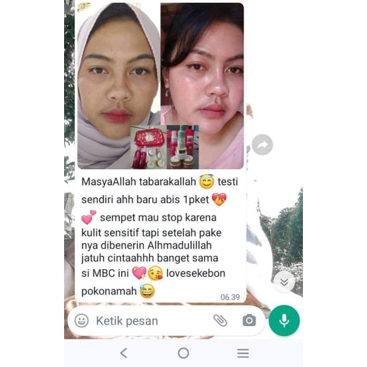 Mbc skincare DNA/pemutih wajah produk ori 100%