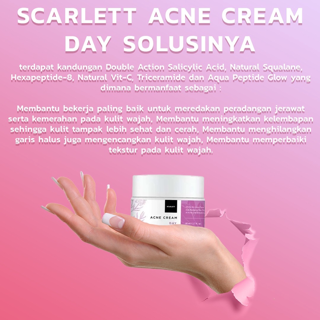 SCARLETT WHITENING ACNE DAY CREAM krim anti acne original