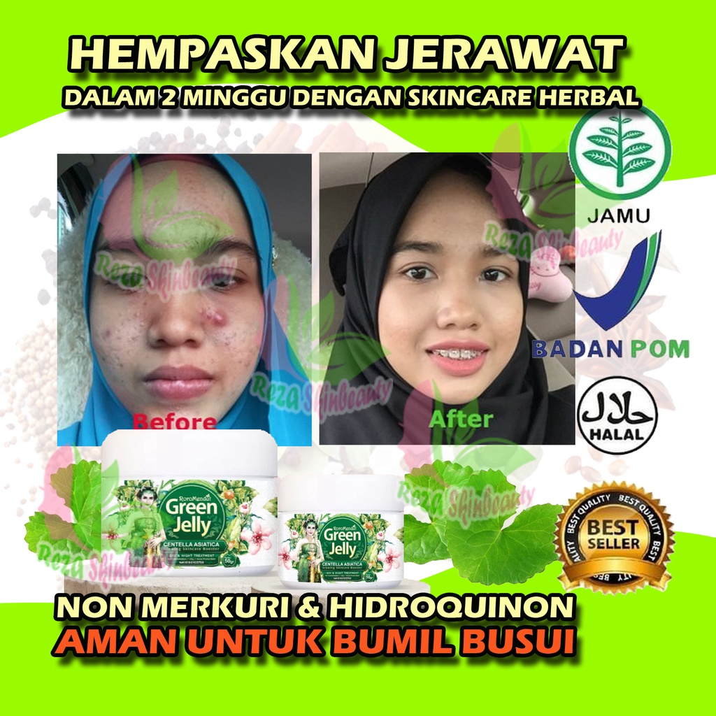 GREEN JELLY ANTI ACNE WHITENING BOOSTER CREAM PENGHILANG JERAWAT PERAWATAN JERAWAT PORI-PORI BESAR O