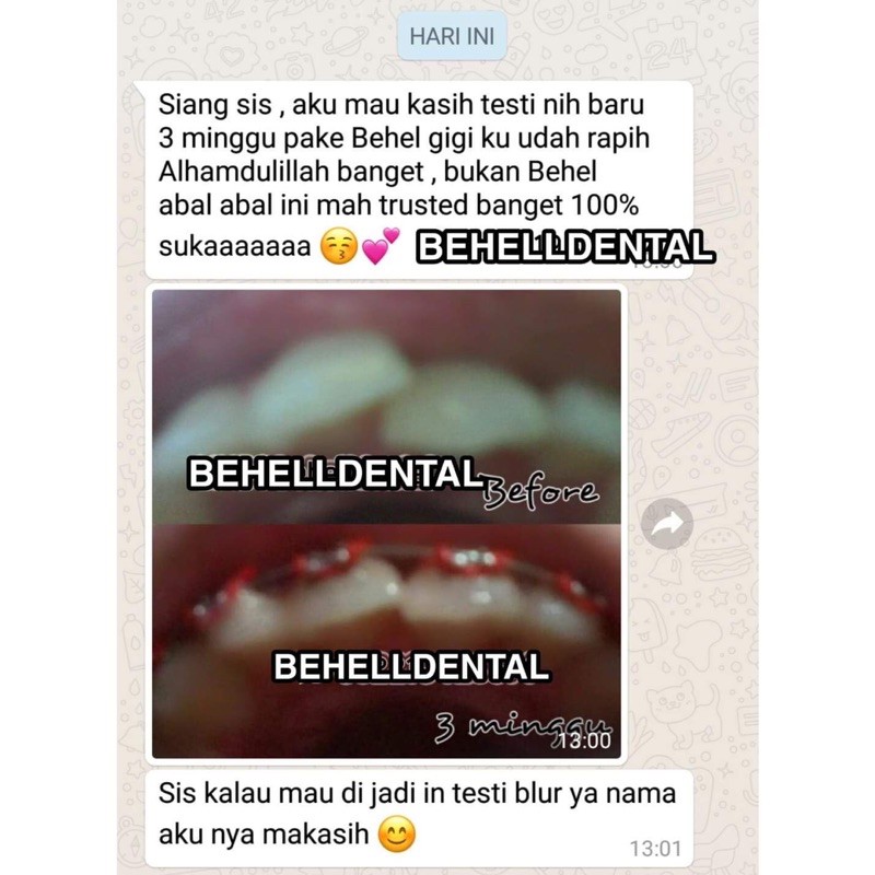 BEHELLDENTAL BRACKET BEHEL METAL GERMANY 345 HOOK . KAWAT GIGI ORTHO PERMANEN ROTH 022 BISA PERBAIKAN PERAWATAN GIGI - DENTAL