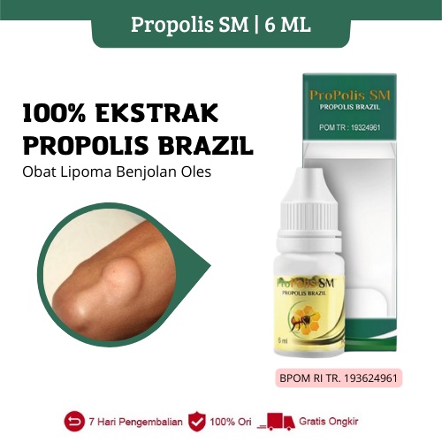 Propolis SM - Obat Lipoma Benjolan Oles - Benjolan Di Leher / Payudara / Tangan / Punggung / Miss v / Selangkangan / Kepala / Ketiak / Kaki