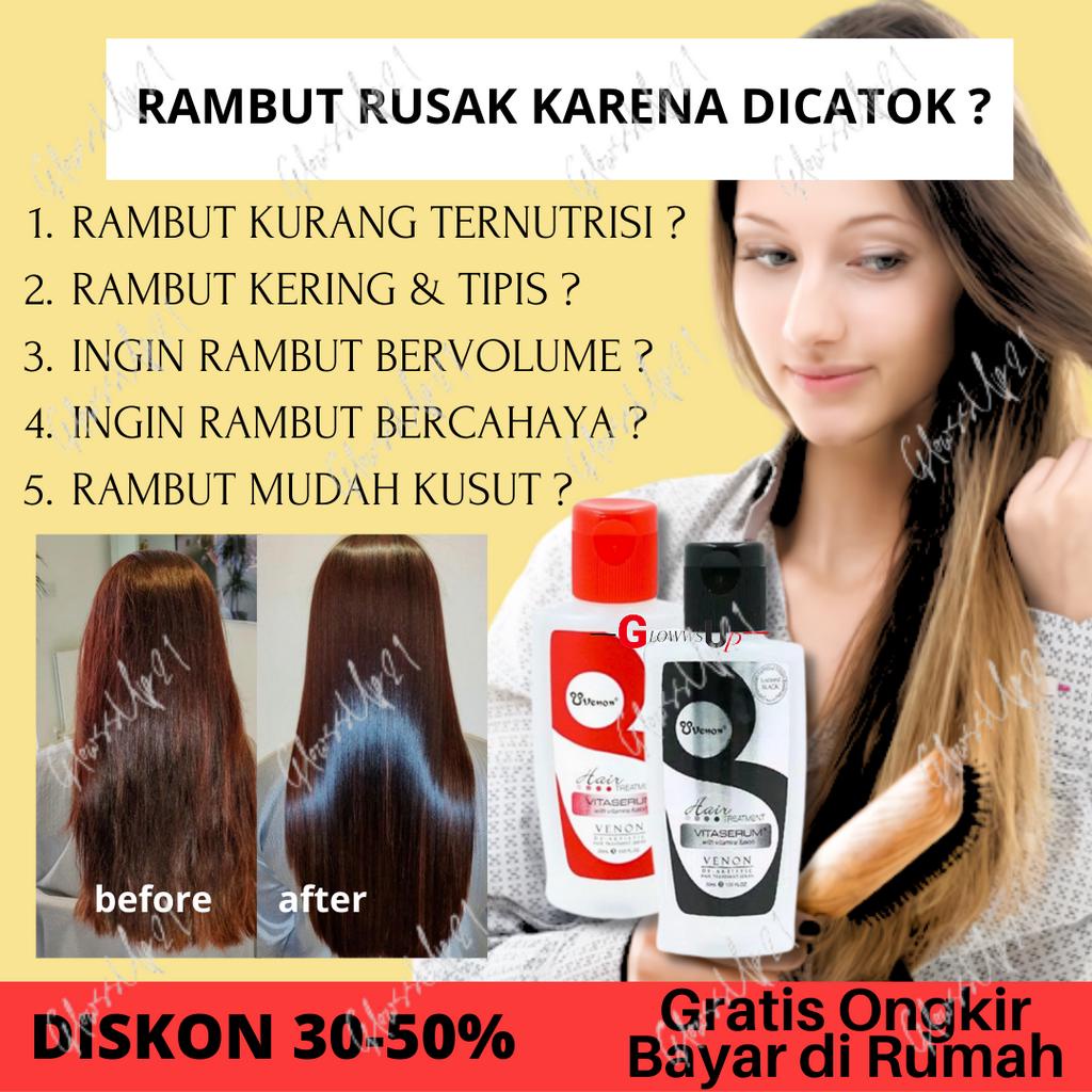 VENON VITA SERUM RAMBUT 30ML BPOM - VITAMIN RAMBUT VENON 30ML ORIGINAL - Hitam