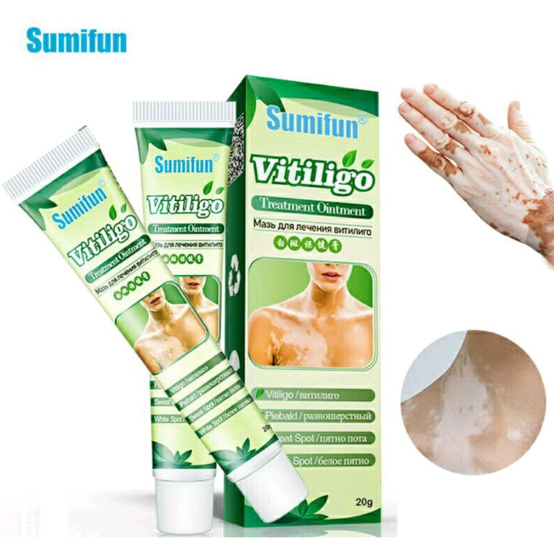 Sumifun Cream Salep Vitiligo Antibakteri