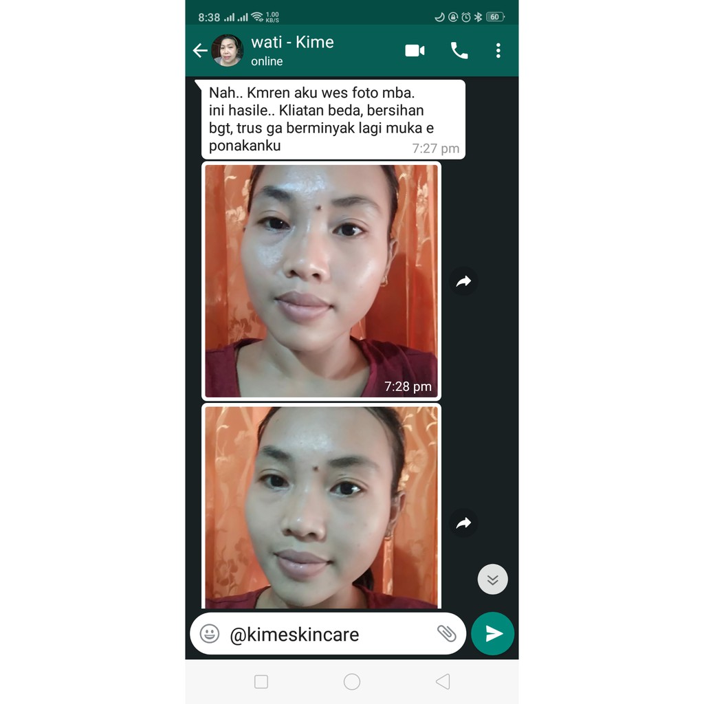 Paket Komplit Glowing KIME Skincare Original 100%