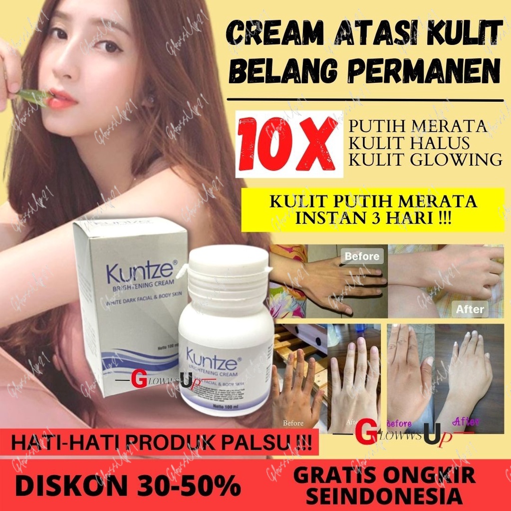 PEMUTIH BADAN KUNTZE BRIGHTENING CREAM WHITE FACIAL N BODY SKIN BRIGHTENING CREAM