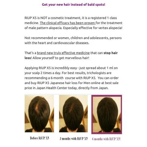 Promo Riup X5 Plus Dijamin murah