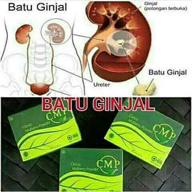 Download 5400 Gambar Ginjal Terbuka Paling Baru Gratis HD