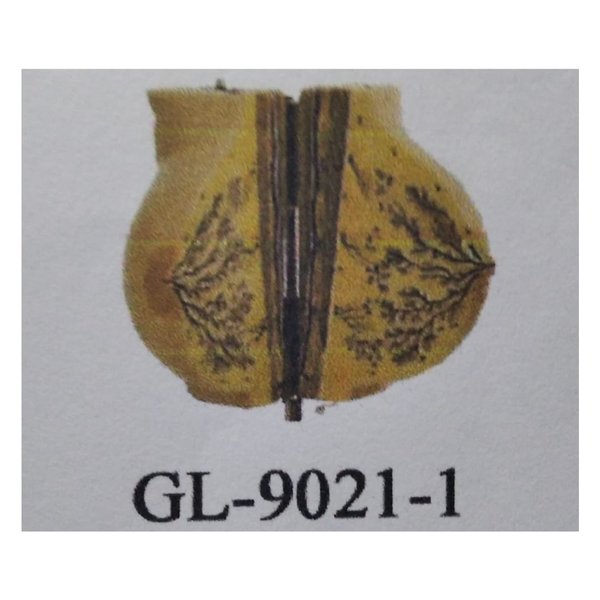 Jual Alat Peraga Model Payudara Mammary Gland In Resting Gl Shopee Indonesia