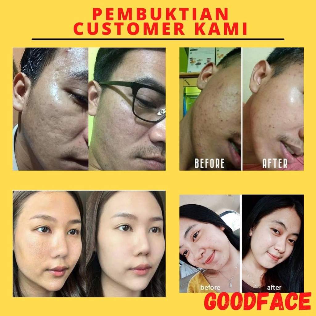 SERUM PENGECIL PORIPORI WAJAH AMPUH SOMETHINC HYLAPORE AWAY SOLUTION TREATMENT WAJAH