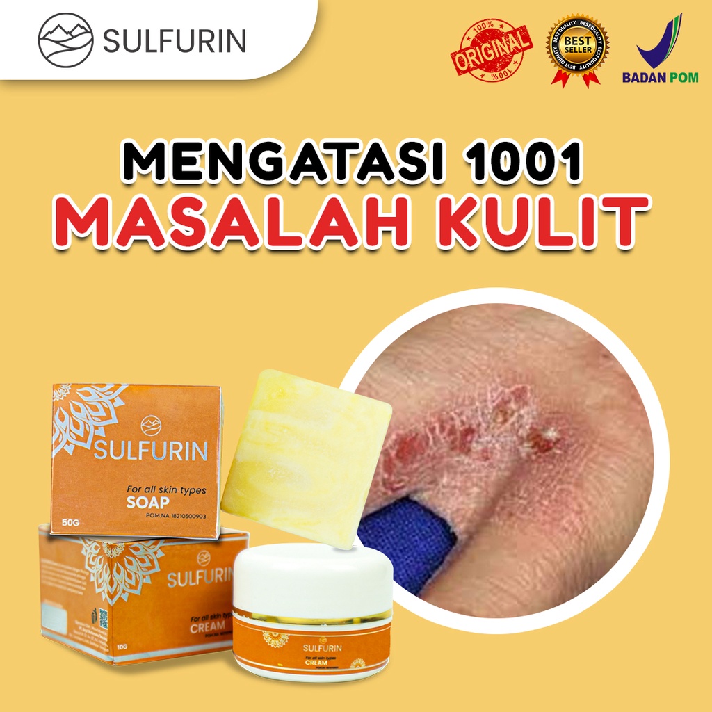 Sabun dan Salep SULFURIN BELERANG Mengatasi Gatal Pada Kulit Obat Skabies Herpes Kutu Air 100% Original BPOM Aman Untuk Segala Usia