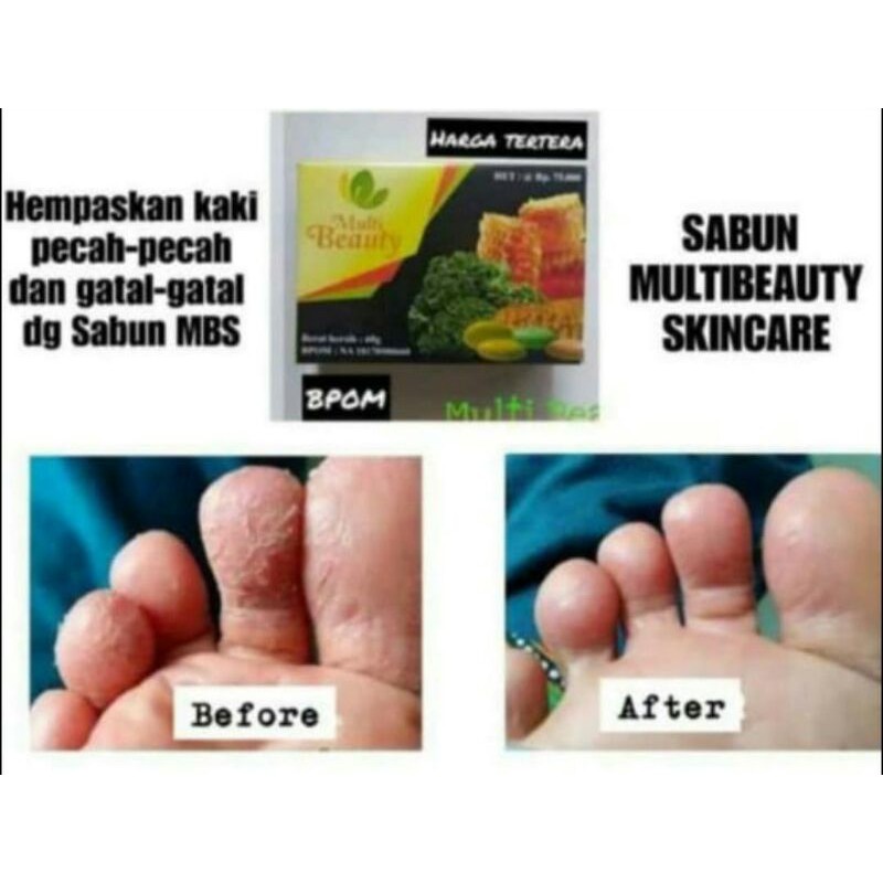 

MultiBeautysoap