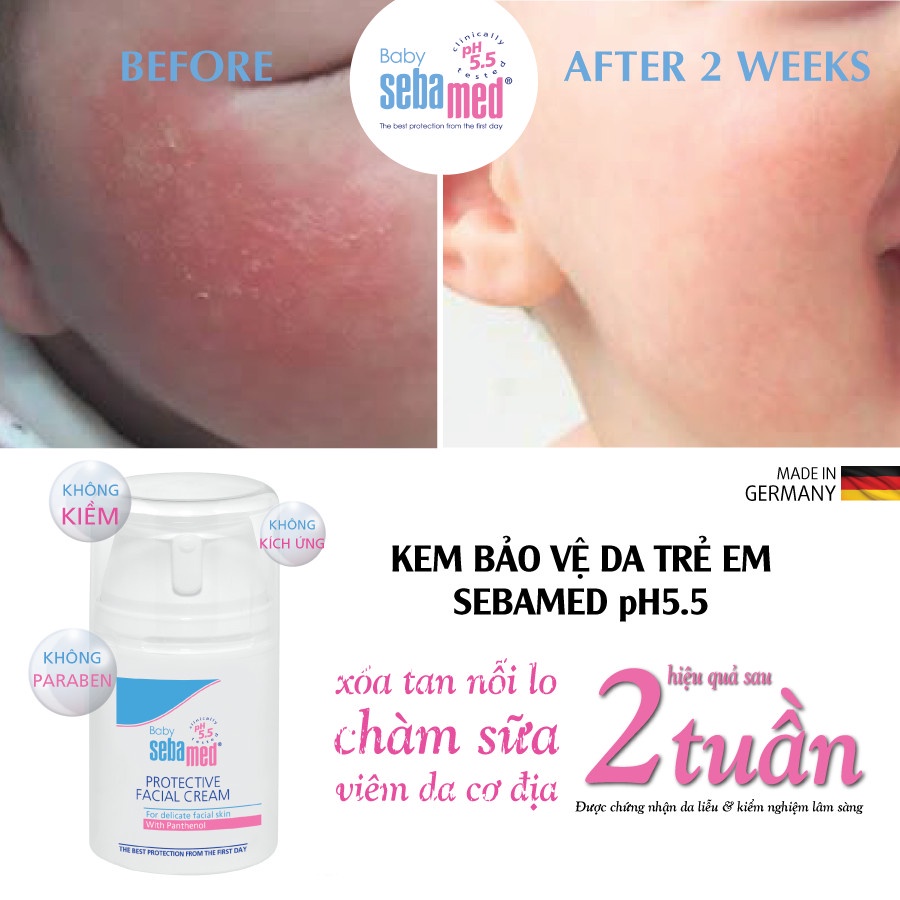 Sebamed Baby Protective Facial Cream 50 ml Original Made in Germany