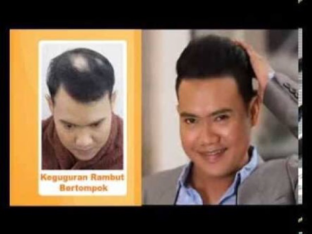 Yun Nam Hair Tonic-4