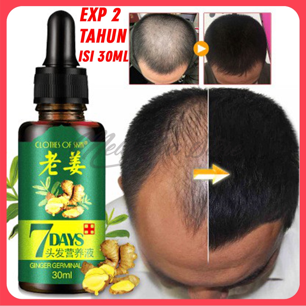 7 Days Clothes Of Skin Minyak Penumbuh Rambut Ginger Germinal Oil