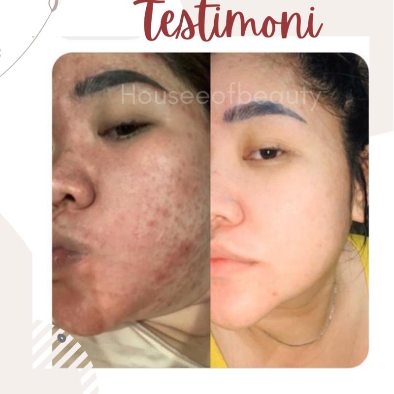 Skincare Cream Pemutih Wajah GLOWING Kosmetik Wanita | NEW SKIN YOUTH REVOLUTION PLUS-6