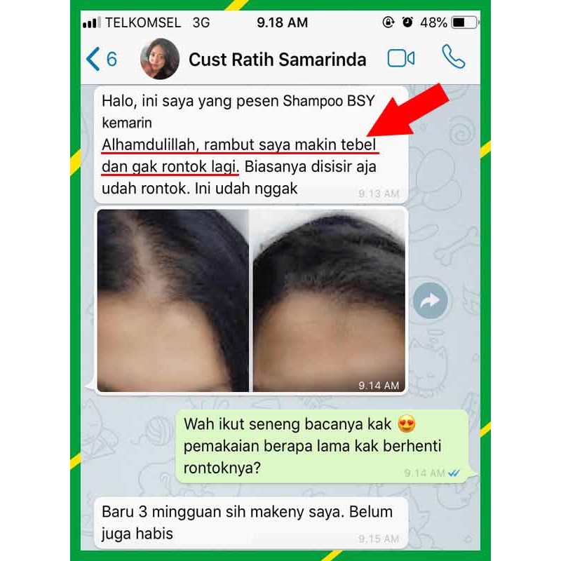 [ORI] 20pcs SHAMPO PENGHITAM RAMBUT ALAMI Hanya dalam 5 Hari Zat Ekstrak Mengkudu Noni BSY 2 Holo