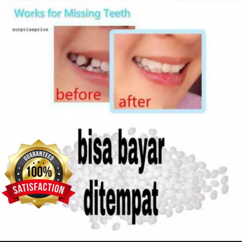 Temptooth/Lem Gigi/Lem Gigi Palsu/Gigi Palsu