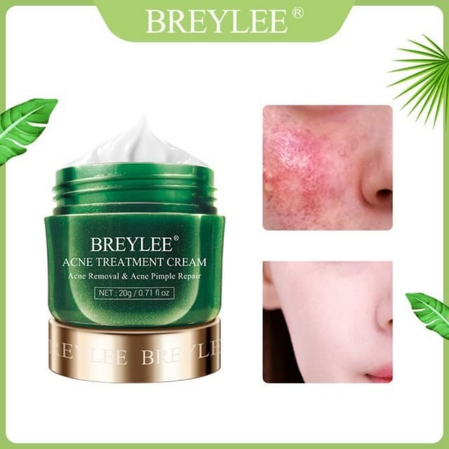 BREYLEE Acne Cream Obat Jerawat Krim Removing Acne/ Blackhead / Pore Reduction 20g