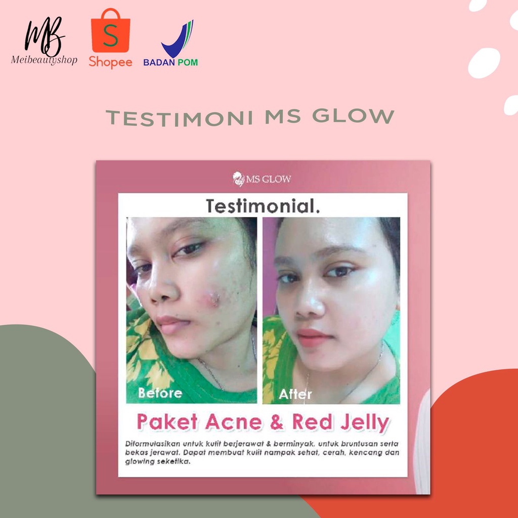 MS GLOW Paketan Dan Eceran TONER, FACIAL WASH, NIGHT CREAM, DAY CREAM,SERUM