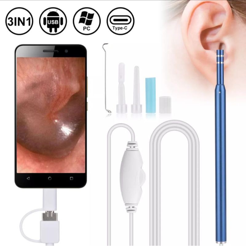 Pembersih Telinga Anak Dewasa Kamera Ear Cleaning Endoscope