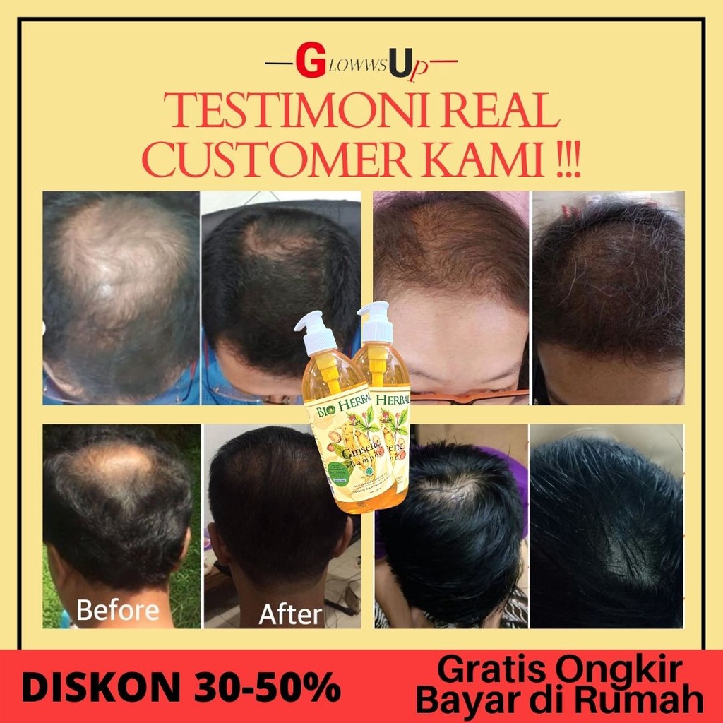 PENUMBUH RAMBUT BOTAK BIO HERBAL SHAMPO GINSENG 500ML NEW SIZE - SHAMPO GINSENG BIO HERBAL