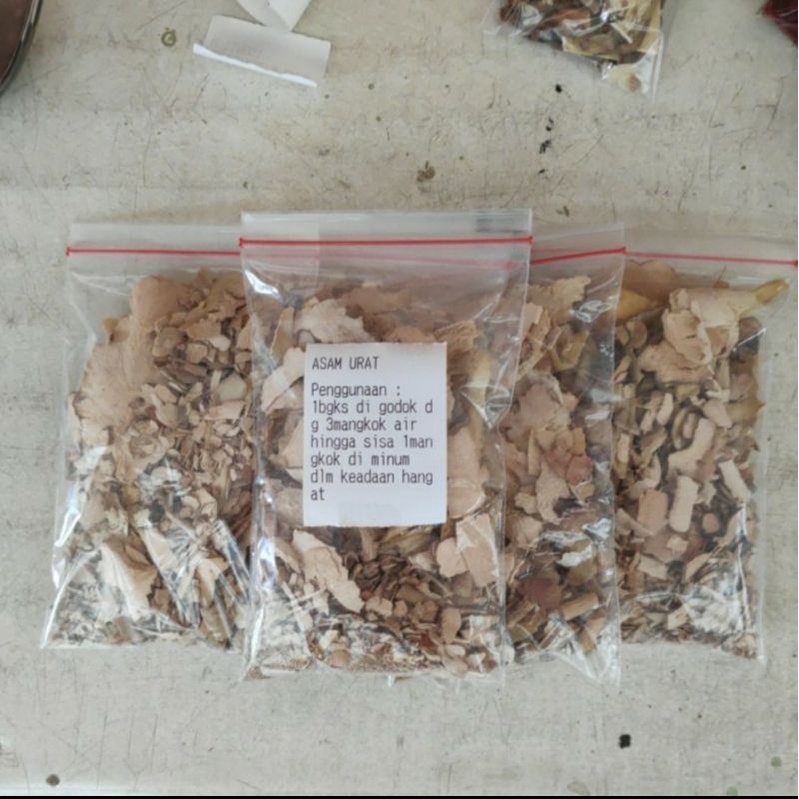 

Foshan Resep Pengobatan Asam Urat