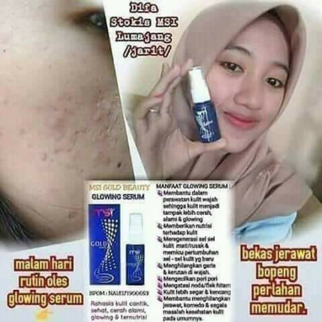Serum glowing MSI