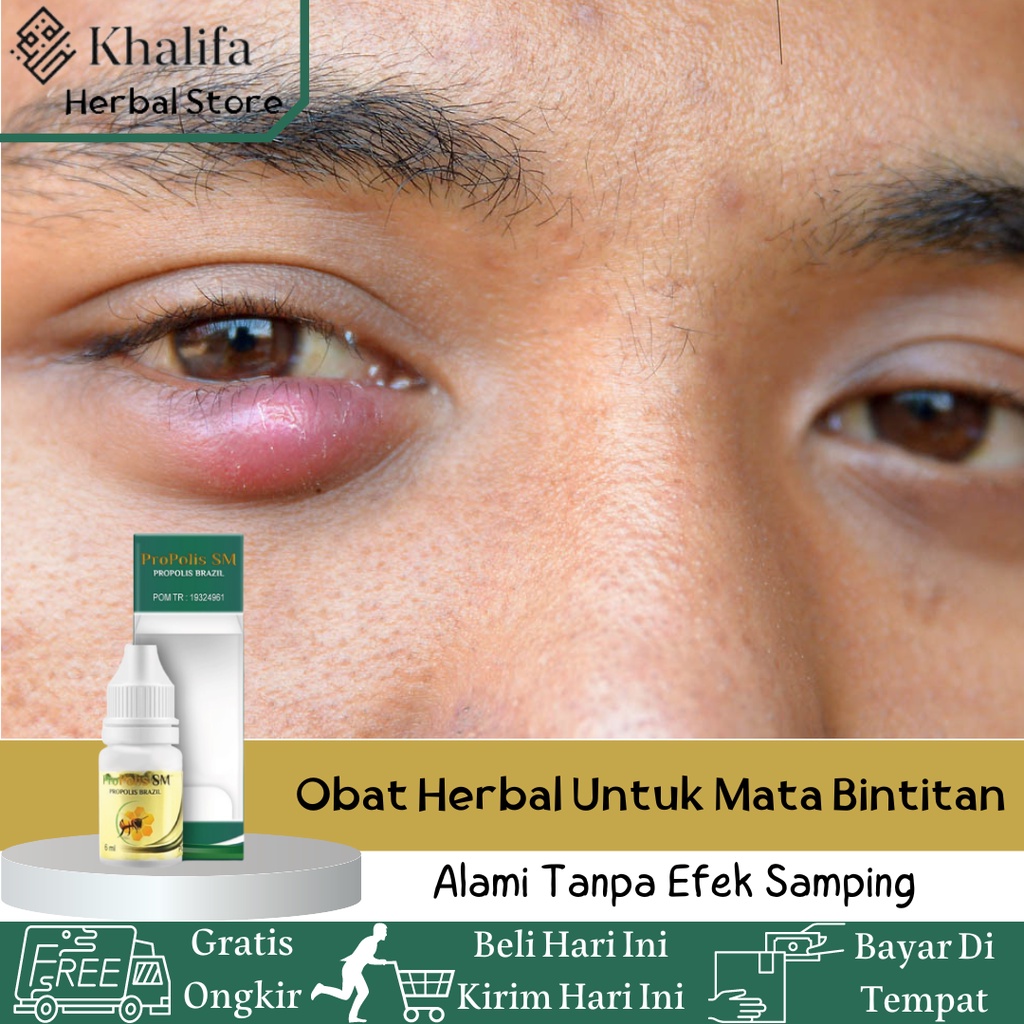 Obat Mata Bintitan, Obat Jerawat Di Mata, Obat Bisul Di Mata, Obat Benjolan Di Kelopak Mata, Obat He