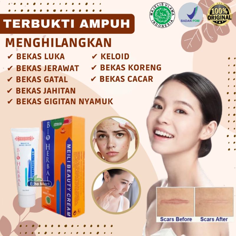 Salep Obat Cream Meilibahenling Penghilang Bekas Luka Lama Hitam Koreng Jerawat Bopeng Melibahenling