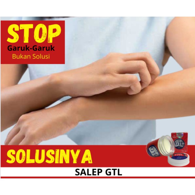 satel salep gatel original salep flek hitam kulit gatal gatal obat salep kurap panu koreng kulit iri