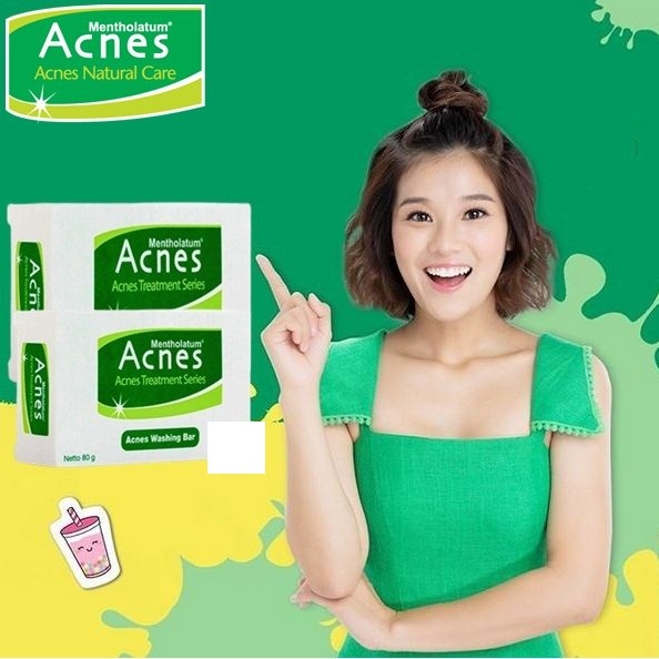 Acnes Creamy Wash Foaming Washing Bar 50g 80g 100g | Sabun cuci muka anti jerawat badan (KIM)