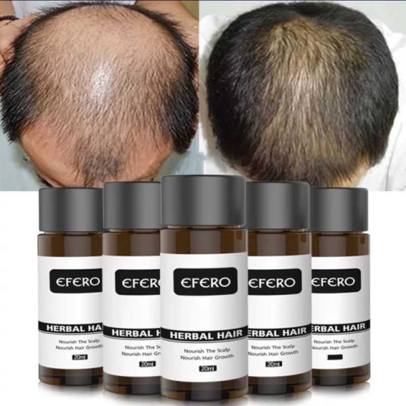 Efero Penumbuh Rambut / Jambang /  Brewok / Alis /Jenggot / Kumis / Efero Hair Growth Essential Oil