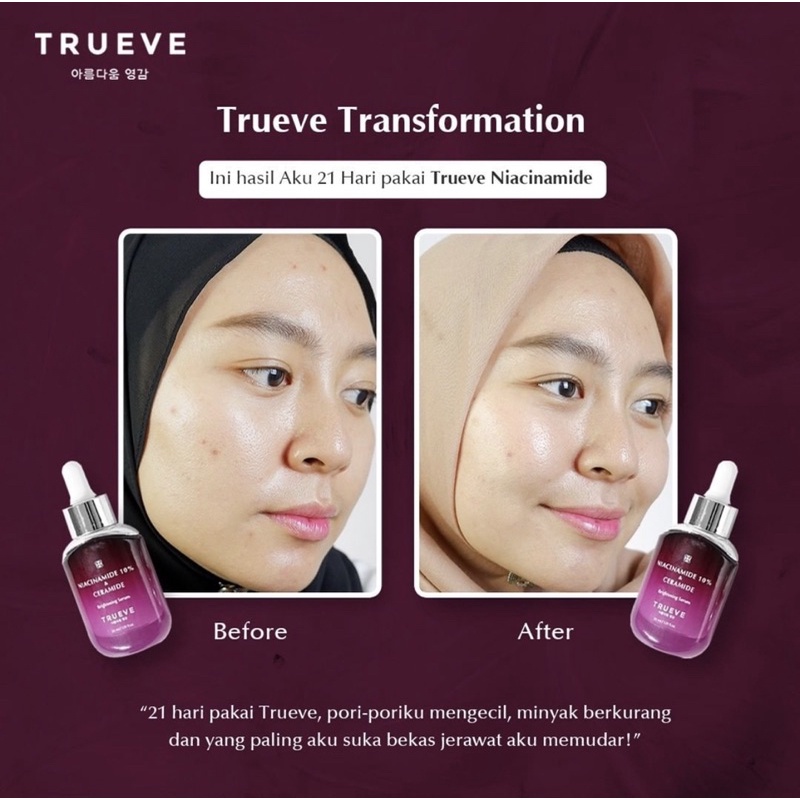 TRUEVE Luminous Dark Spot Brightening Serum