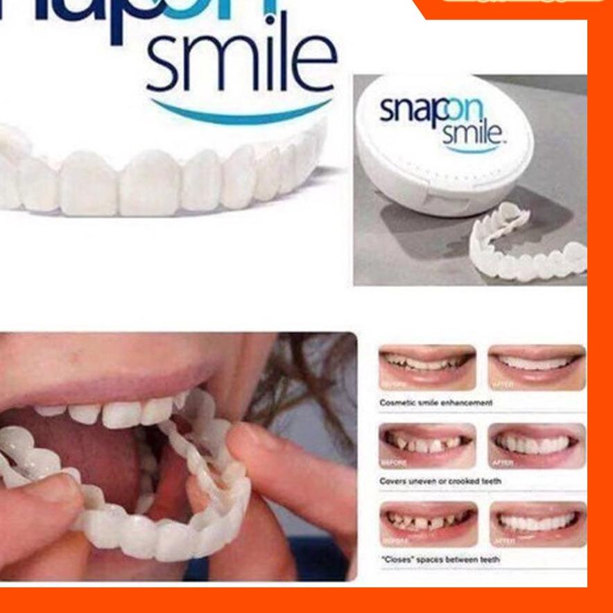Terjangkau Gigi palsu  gigi palsu instan atas bawah Snap On Smile Gigi Palsu 1 Set Atas Bawah - Gigi Palsu Silikon