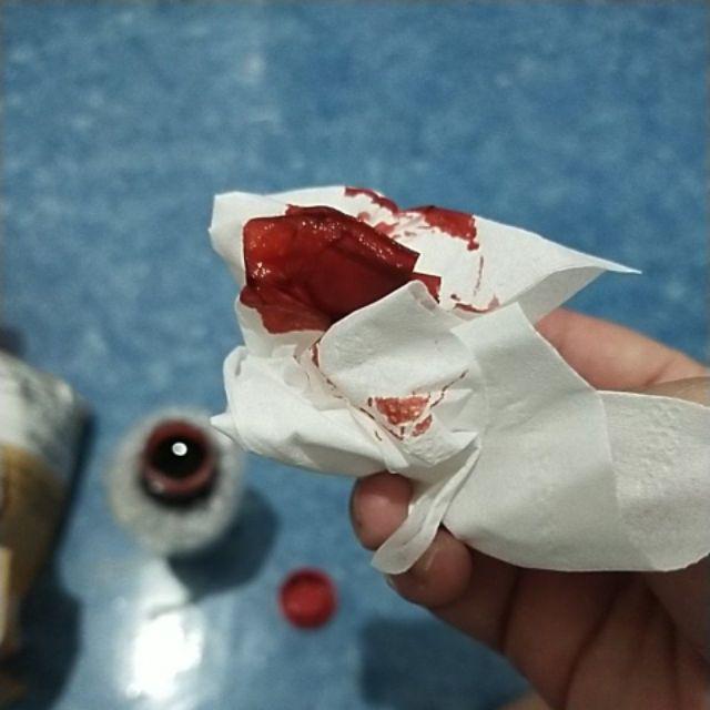 foto muntah darah di tisu