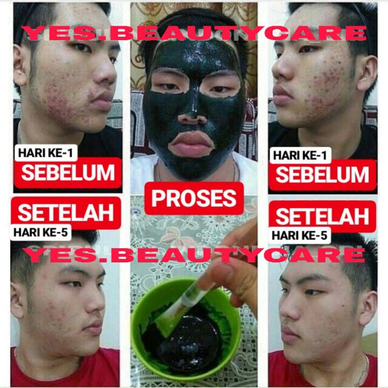 [ORIGINAL] MASKER SPIRULINA TIENS 100% ANTI JERAWAT