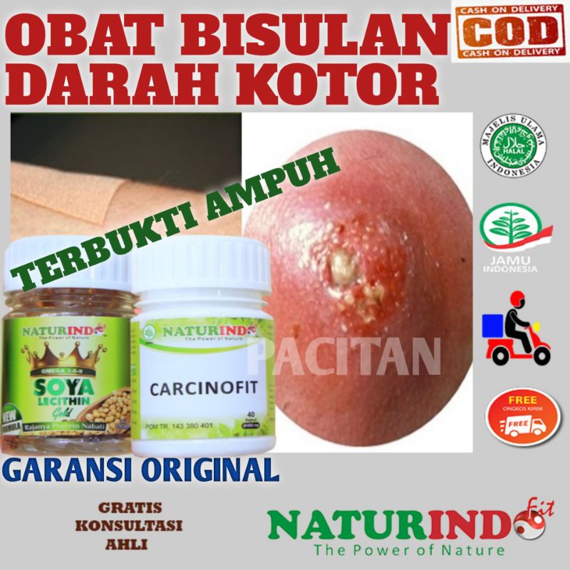 Harga Ubat Bisul Di Farmasi